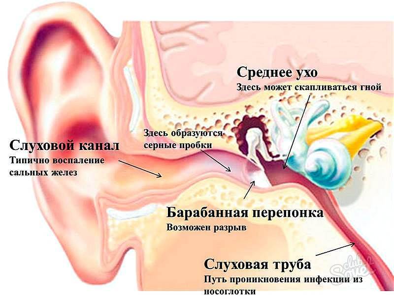 Болит ухо: что делать и как лечить в домашних условиях