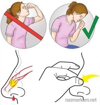 Кровь из носа при насморке: причины почему кровит во время простуды у взрослого, что делать если периодически кровоточит