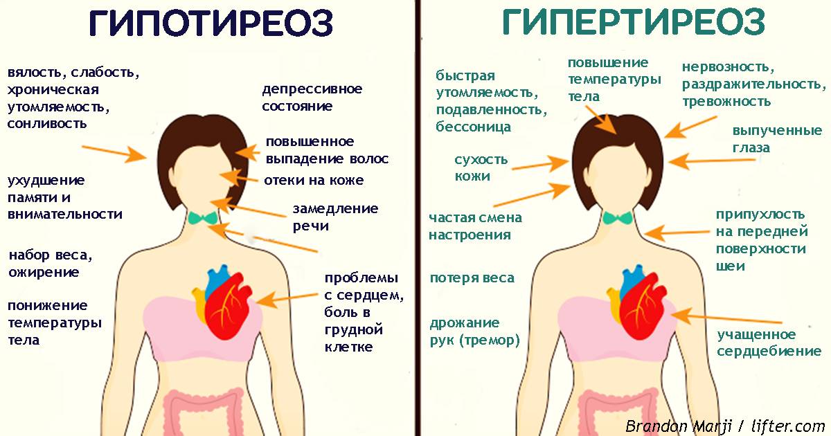 ᐉ признаки повышенного ттг у женщин при климаксе - sp-medic.ru