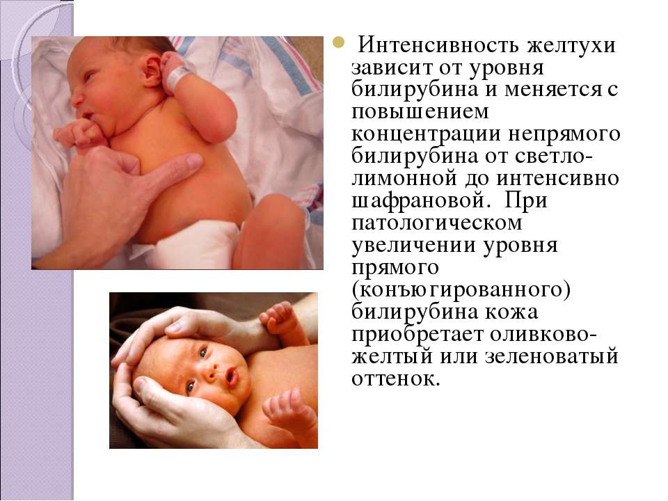 Билирубин при желтухе у новорожденных