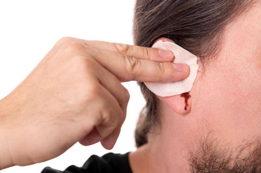 Болит ухо: как лечить в домашних условиях