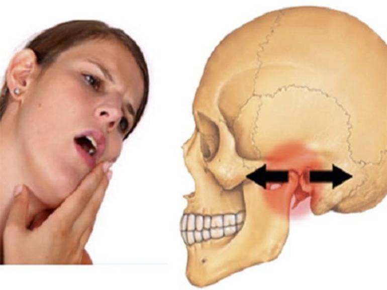 Челюсть щелкает и хрустит с одной стороны при открытии рта и жевании: почему болит сустав и что делать?