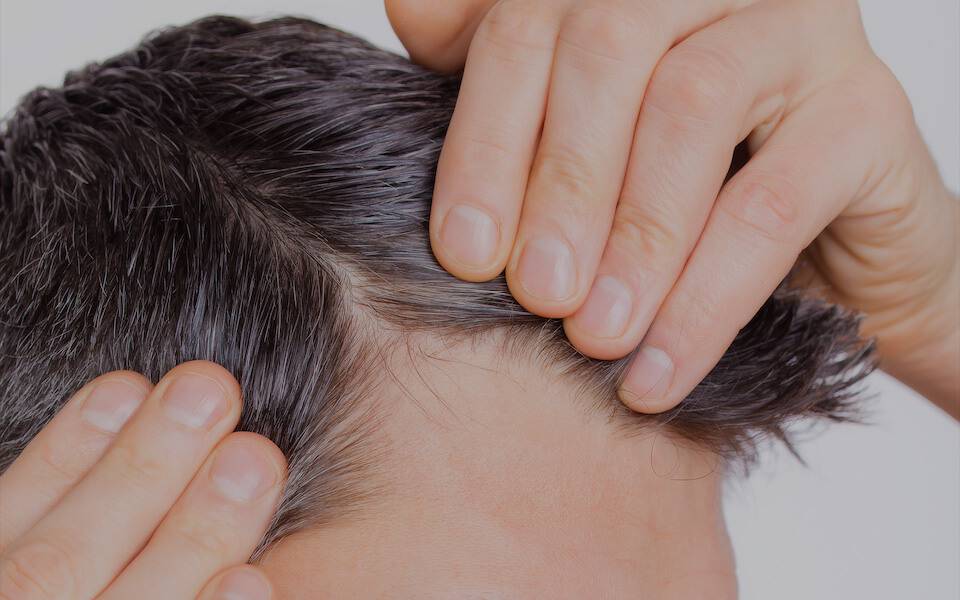 Как лечить волосы и человеку от человека
