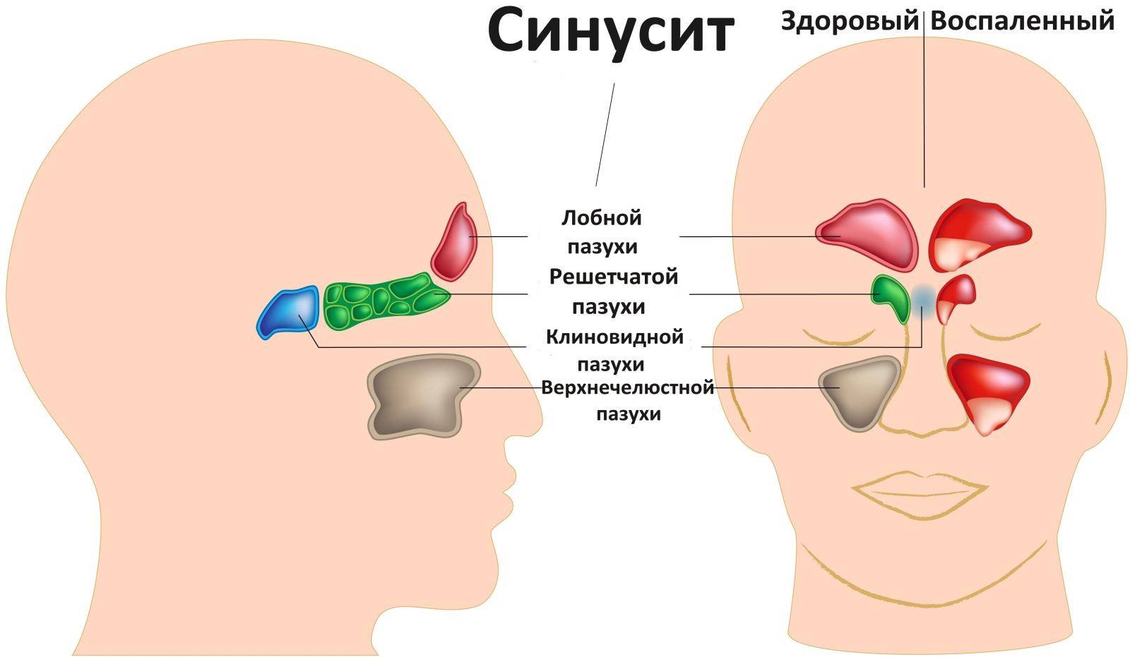 Болячки под носом: лучшие способы лечения