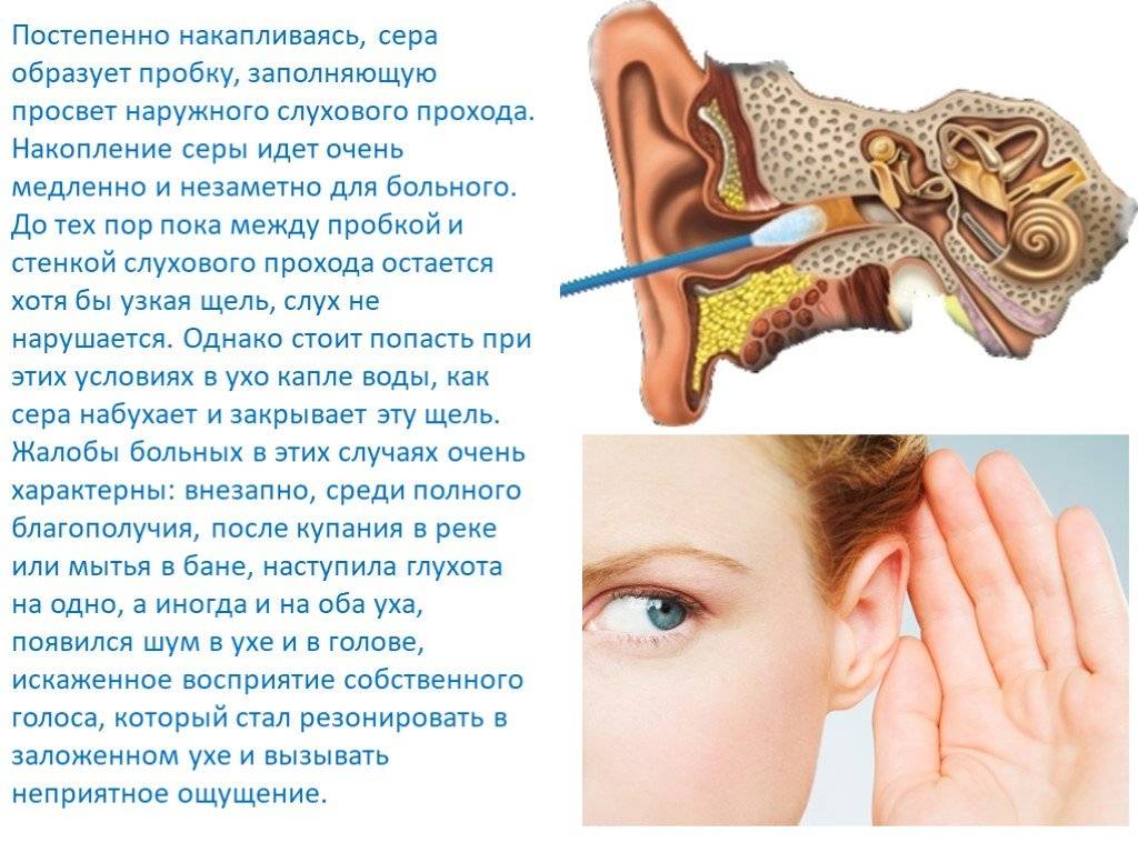 Заложенность уха, шум, звон. причины, симптомы и лечение