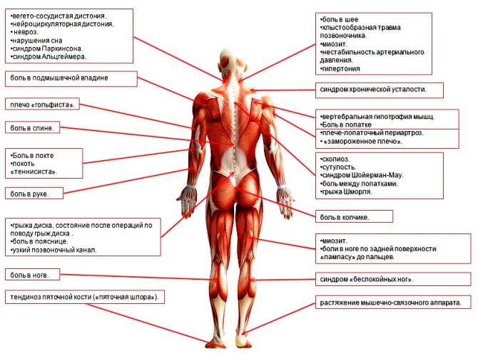 Сводит мыщцы на руках, ногах: причины, симптомы и лечение