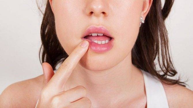 Трещины в уголках губ: причины у взрослого и ребенка