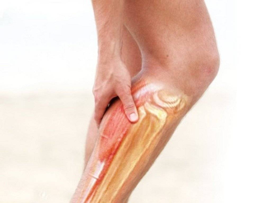 Боль в мышцах голени сзади: причины, симптомы заболеваний, лечение