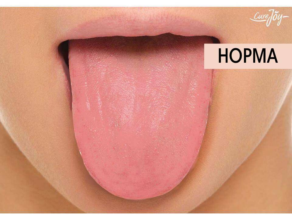 На нервной почве жжение языка | здоровье зубов