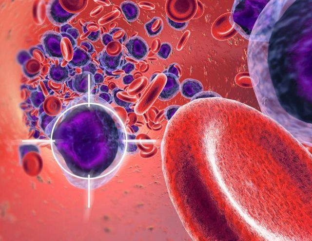 Повышенные лимфоциты в крови у ребенка: 7 причин повышения, подготовка к анализу, расшифровка результатов