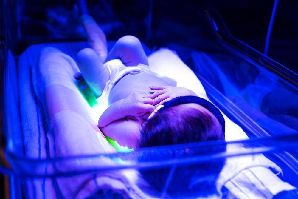 Фототерапия новорожденных при желтухе: лечение в больнице и дома