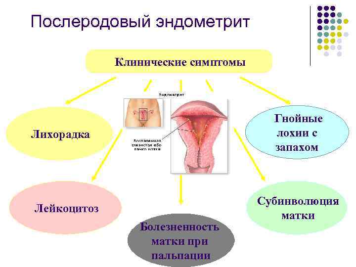 Эндометрит | симптомы | диагностика | лечение - docdoc.ru