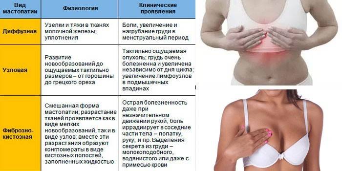 Лечение фиброзно-кистозной мастопатии народными средствами | aptekins.ru