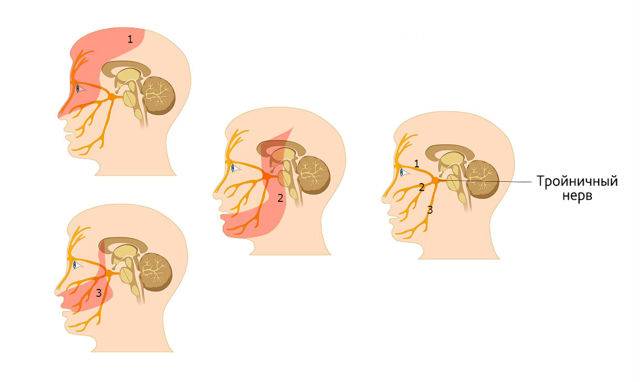 Неврит слухового нерва – острый и хронический. причины, симптомы, диагностика и лечение неврита слухового нерва :: polismed.com