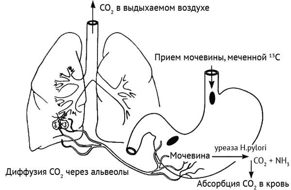 Дыхательный тест желудка