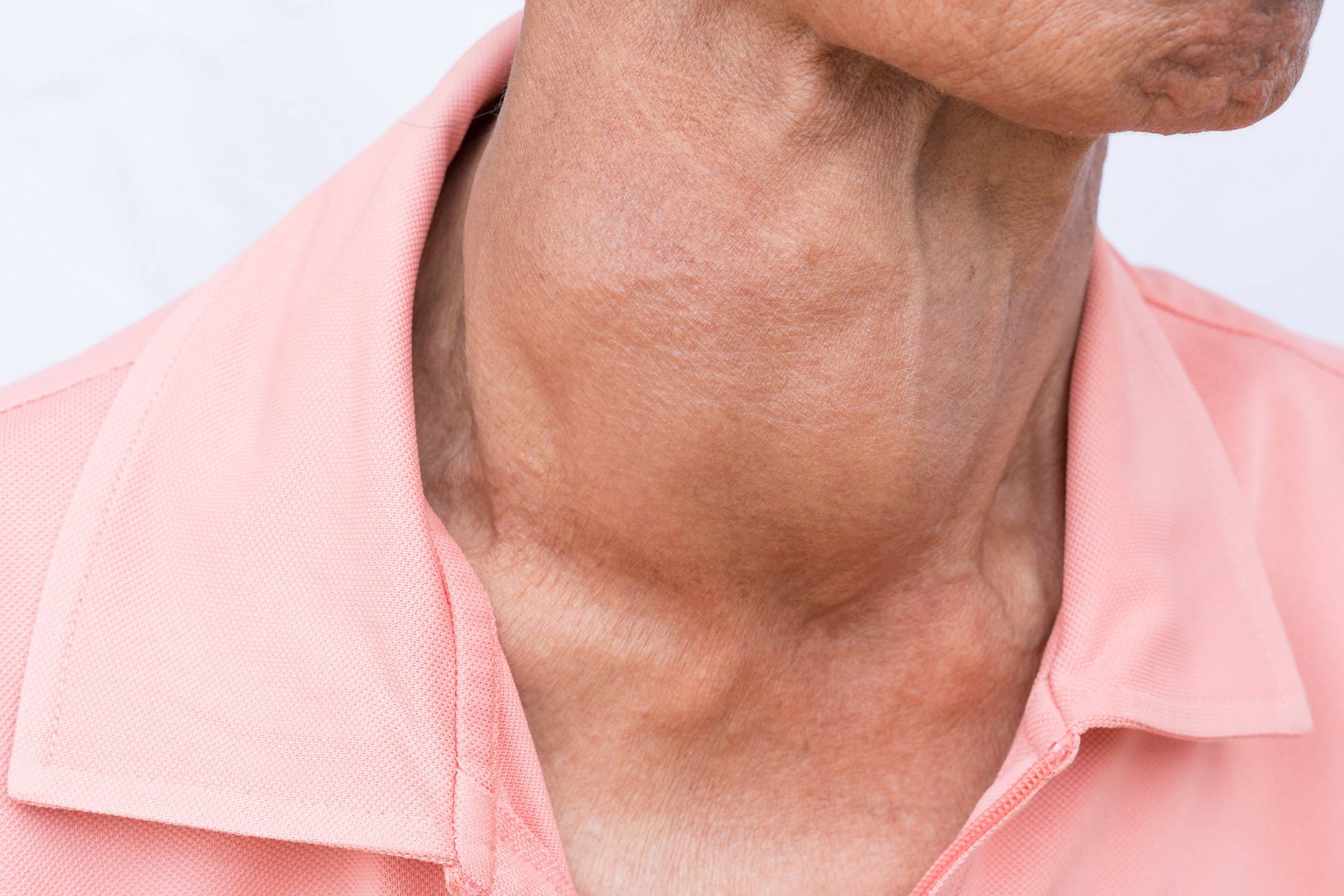 Какие признаки у мужчин указывают на проблемы со щитовидкой