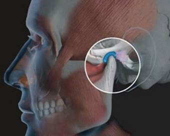 Почему болит челюсть возле уха: находим и устраняем причину