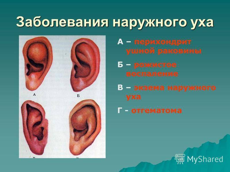 Болит ушная раковина снаружи при надавливании: причины, лечение pulmono.ru
болит ушная раковина снаружи при надавливании: причины, лечение
