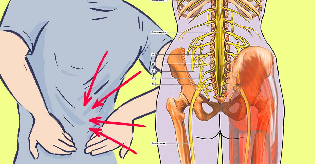 Боли в спине в области поясницы причины лечение и отдает в ногу чем лечить боль