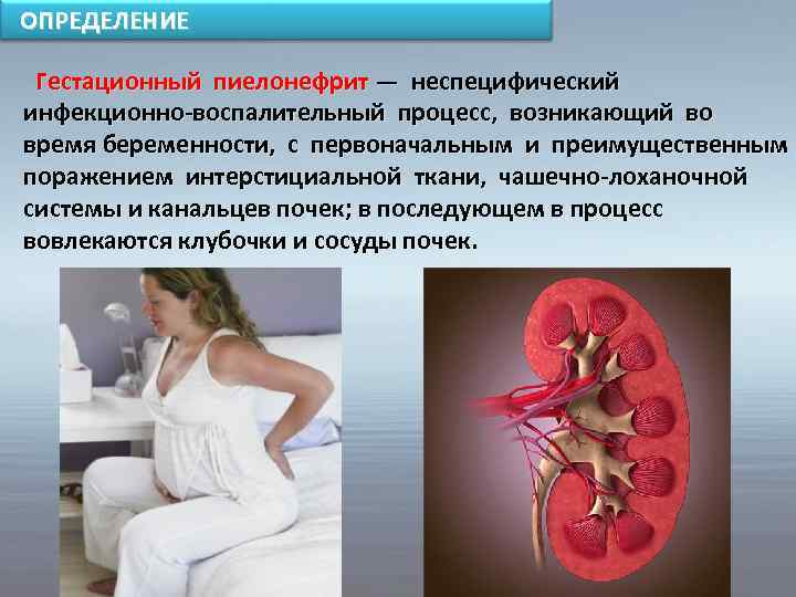 Обострения пиелонефрита при беременности