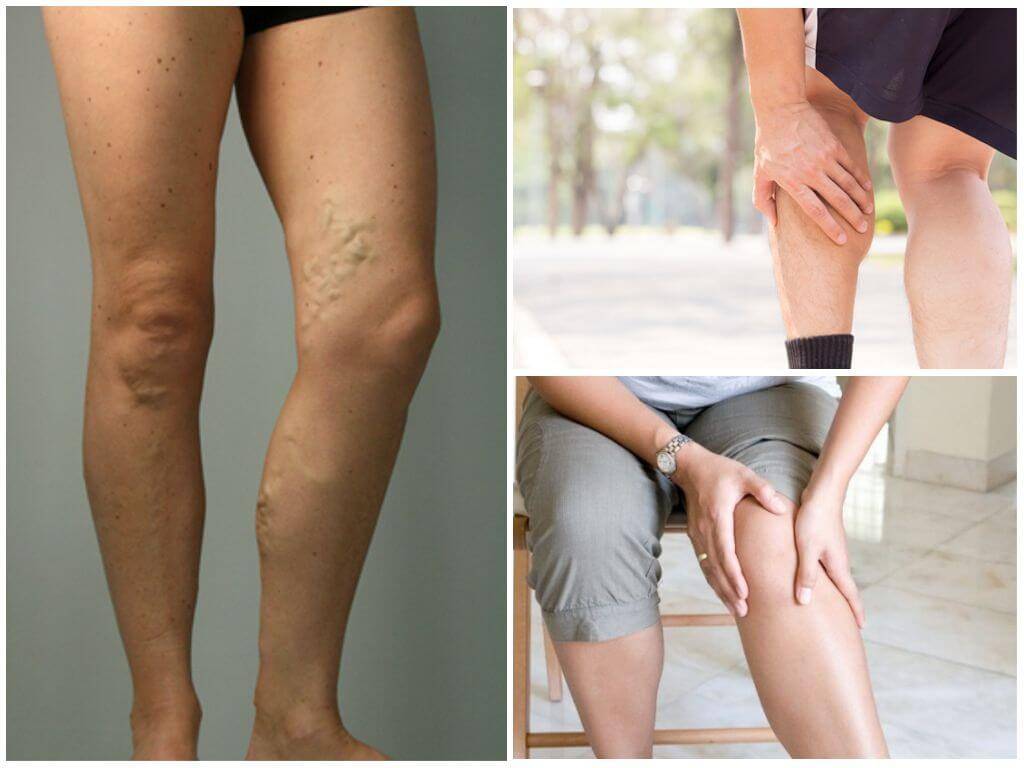 Болят ноги от колена до ступни: причины и лечение