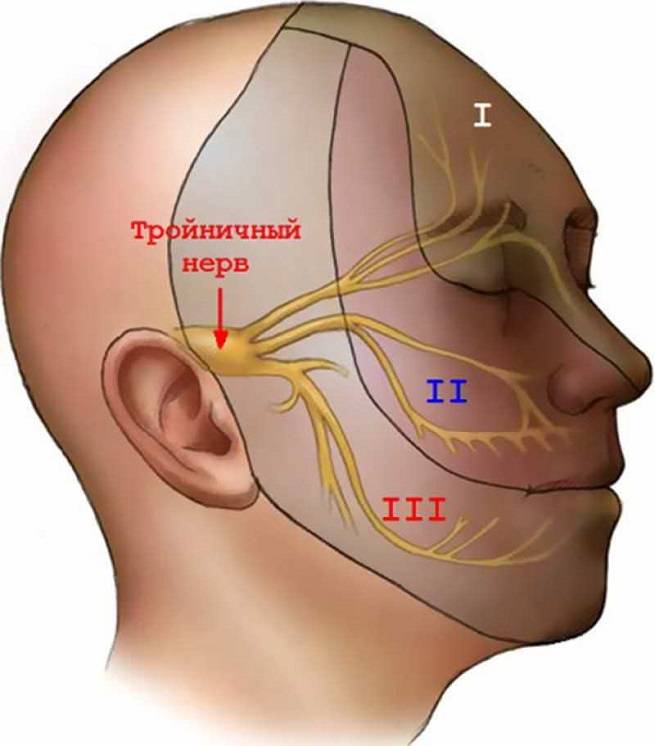Невралгия тройничного лицевого нерва