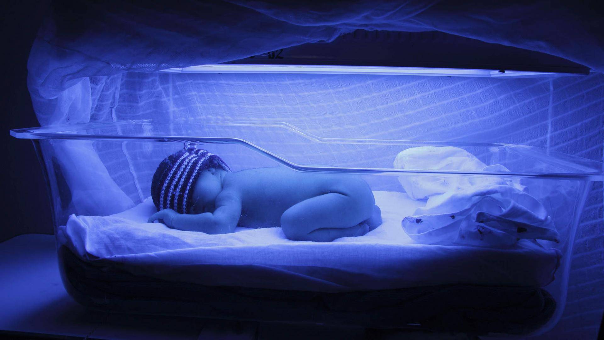 Фототерапия новорожденных