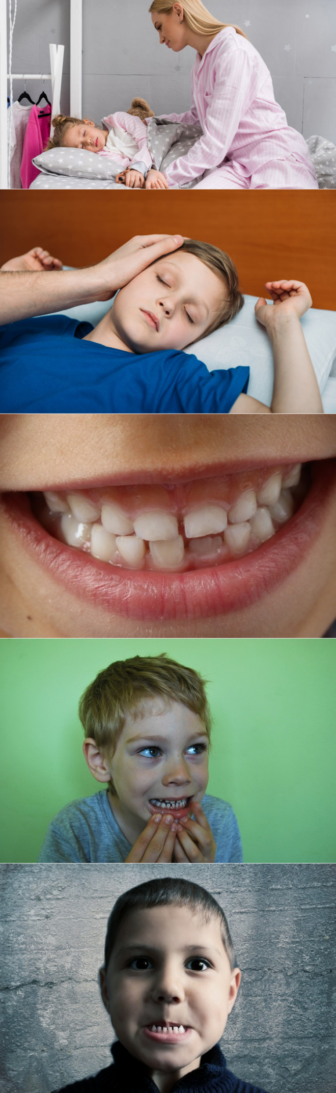Почему спящий скрипит зубами. Скрежет зубами во сне у ребенка. Деформированные зубы у детей.