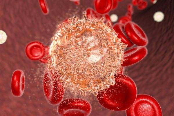 Повышены лимфоциты у ребенка в крови: что это значит, причины и что делать