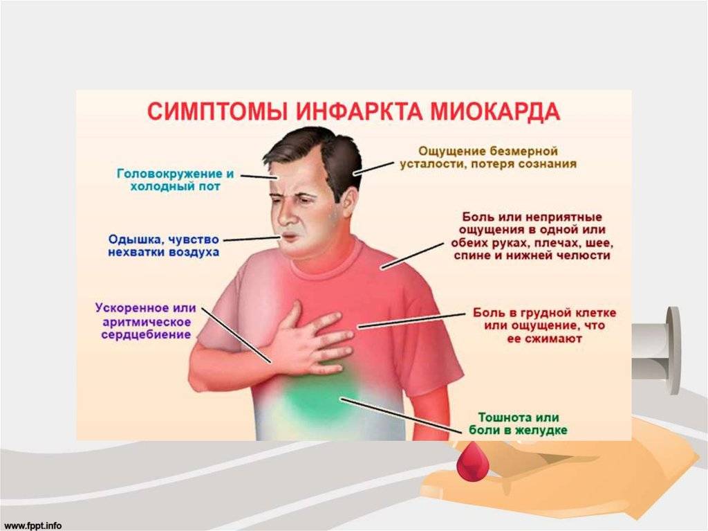 Болит под правой мышкой. Клинические проявления инфаркта миокарда. Клинические симптомы инфаркта миокарда. Причины боли в грудной клетке у мужчин посередине спереди. Боль в центре грудной клетки спереди.