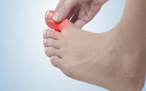 Причины боли в ногте на большом пальце ноги при нажатии