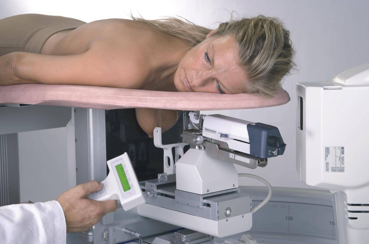 Маммография обязательно. Стереотаксическая биопсия молочной железы. Рентген молочных желез маммография аппарат. Ультразвуковая маммография аппарат.