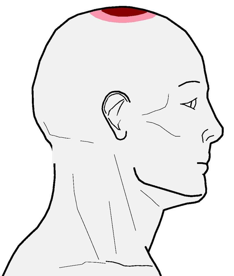 Боль в затылке: почему болит правая и левая затылочная часть у основания черепа, причины и лечение