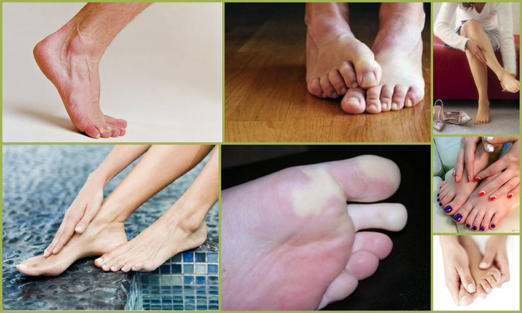 Что делать если болит второй палец на ноге при ходьбе в обуви причины и лечение