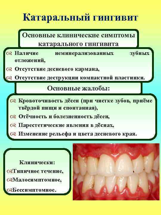 Причины кровотечения десен при чистке зубов и его лечение