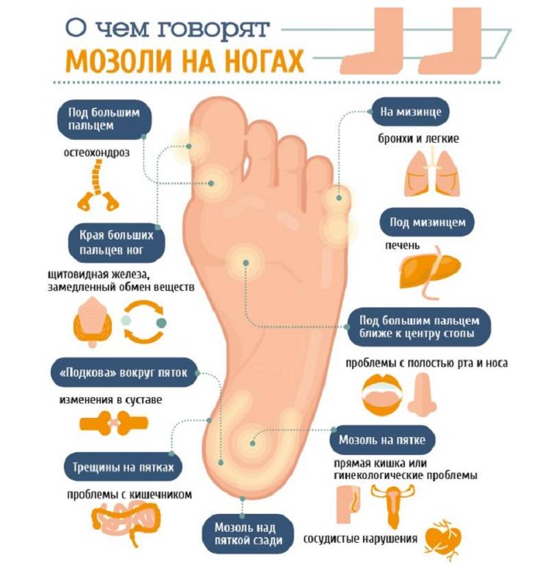 Причины и лечение острой боли в суставах большого пальца ноги
