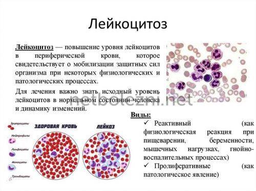 Повышены лейкоциты в крови - что это значит и что делать?
