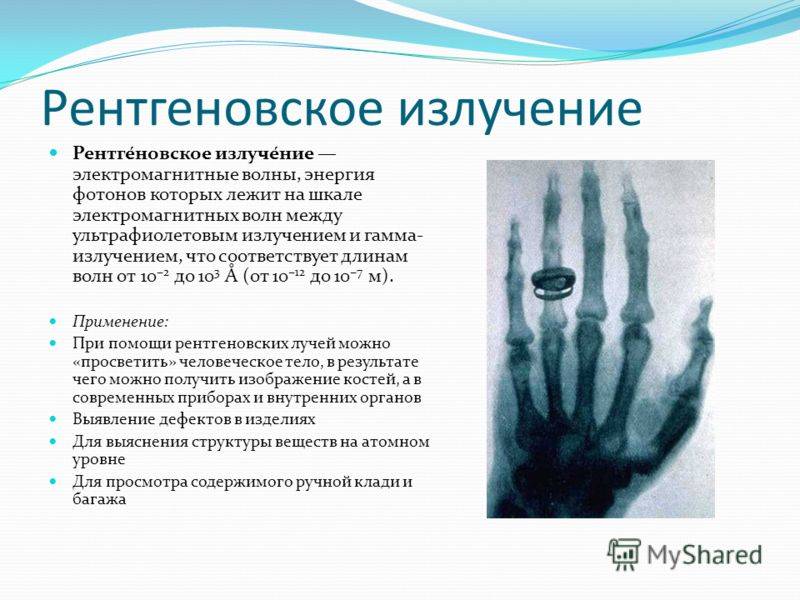 Устройство и принцип работы рентгеновского аппарата