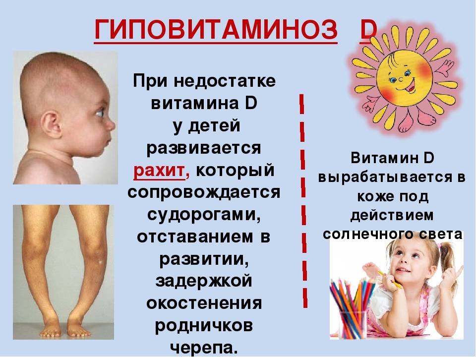 Симптомы передозировки витамином д у грудничков, детей и взрослых
