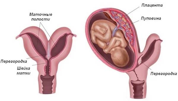 На каком сроке узи показывает беременность (21 фото): когда можно определить и видна беременность, на какой неделе на ранних сроках покажет беременность после зачатия