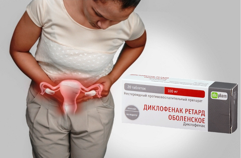 Воспаление яичников у женщин: симптомы, причины и лечение в домашних условиях