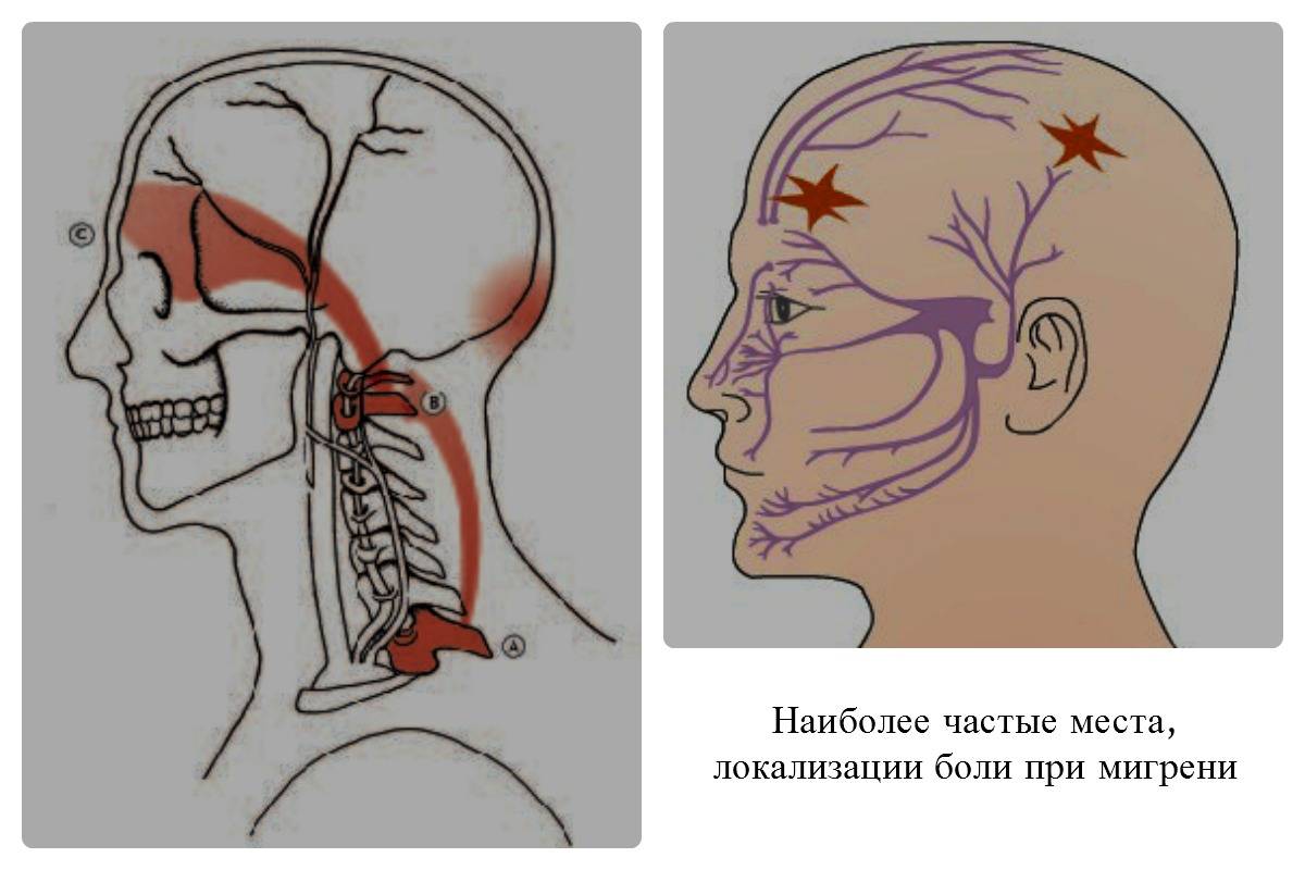 Что означает головная боль в затылочной части головы