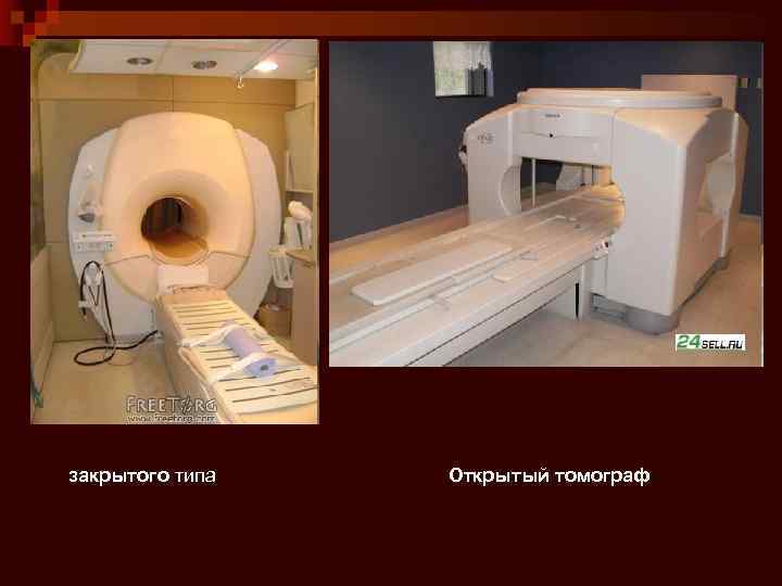 Аппарат для мрт закрытого и открытого типа — в чем разница и какой лучше, как выглядит томограф?