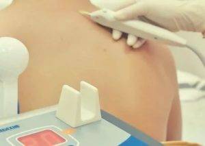 Карбокситерапия - газовые уколы для спины и суставов: особенности процедур, показания и противопоказания