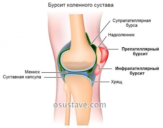 Болят колени с внутренней стороны на обеих ногах | spinahelp.ru