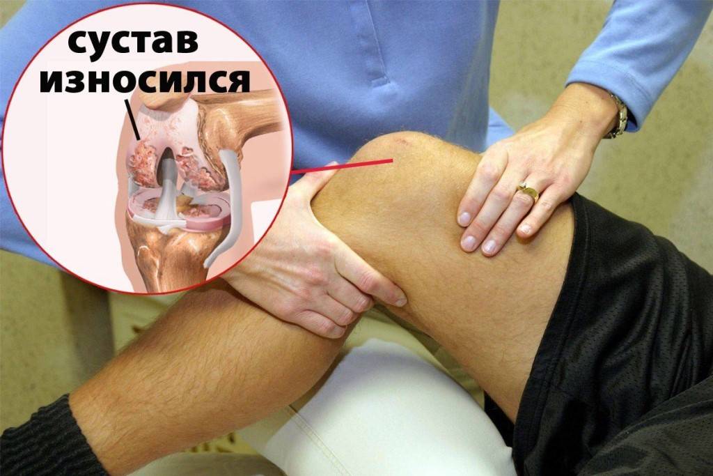 Болит колено с внутренней стороны: причины, возможные болезни, лечение