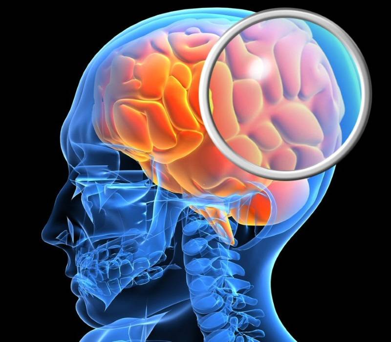 Повреждения головного мозга возникают. Поврежденный головной мозг.