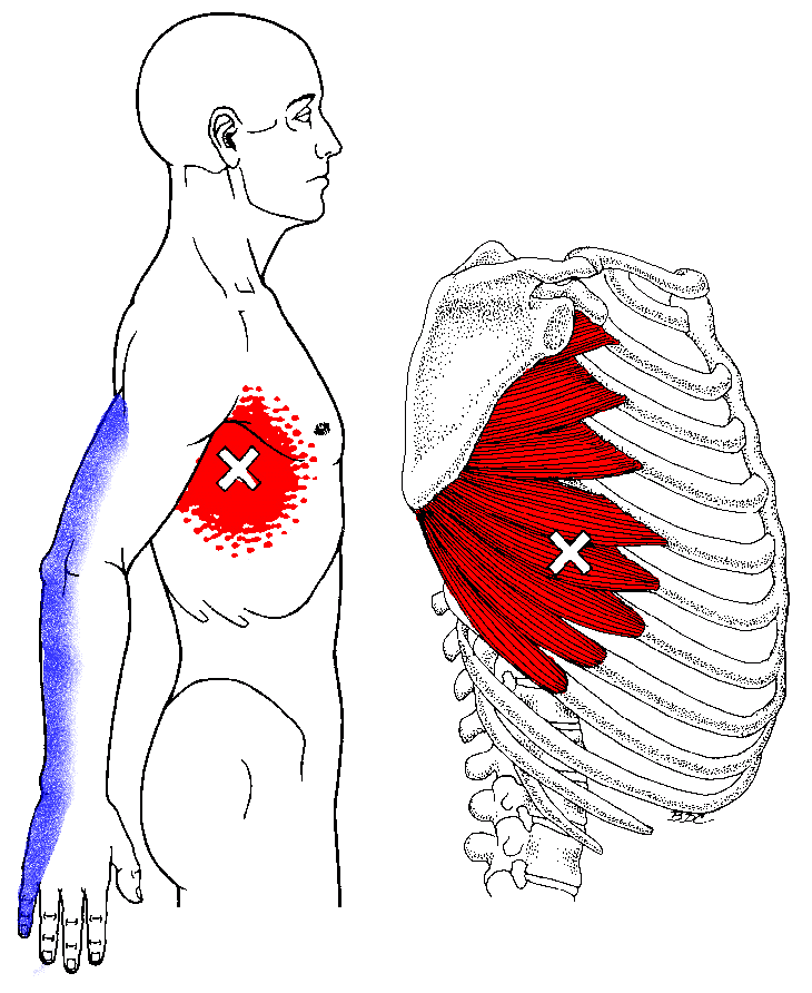 Давящая боль в грудной клетке слева, причины и лечениевсд