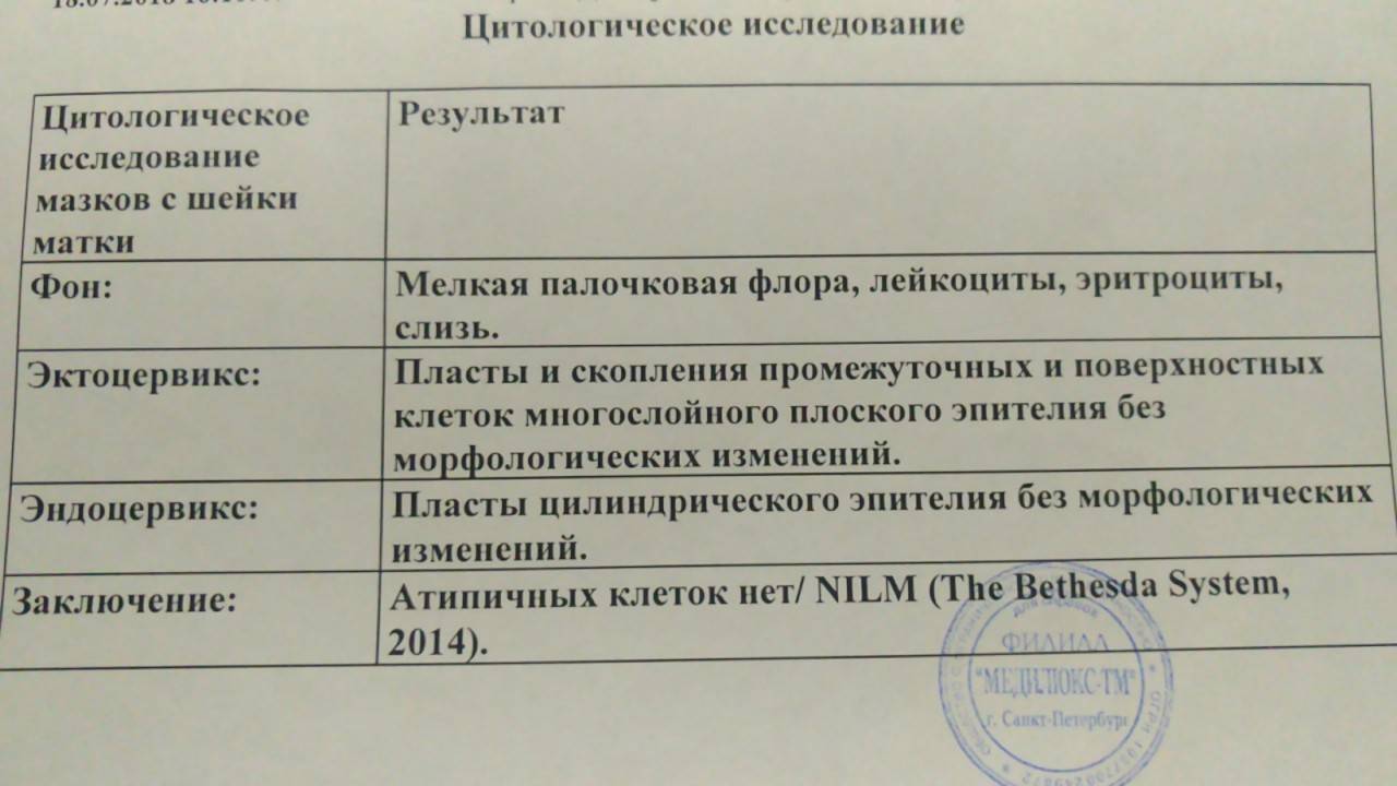 Анализ на цитологию. Результат цитологического исследования мазка. Мазок на о/ц что это. Цитология Результаты анализов. Цитологическое исследование шейки матки.