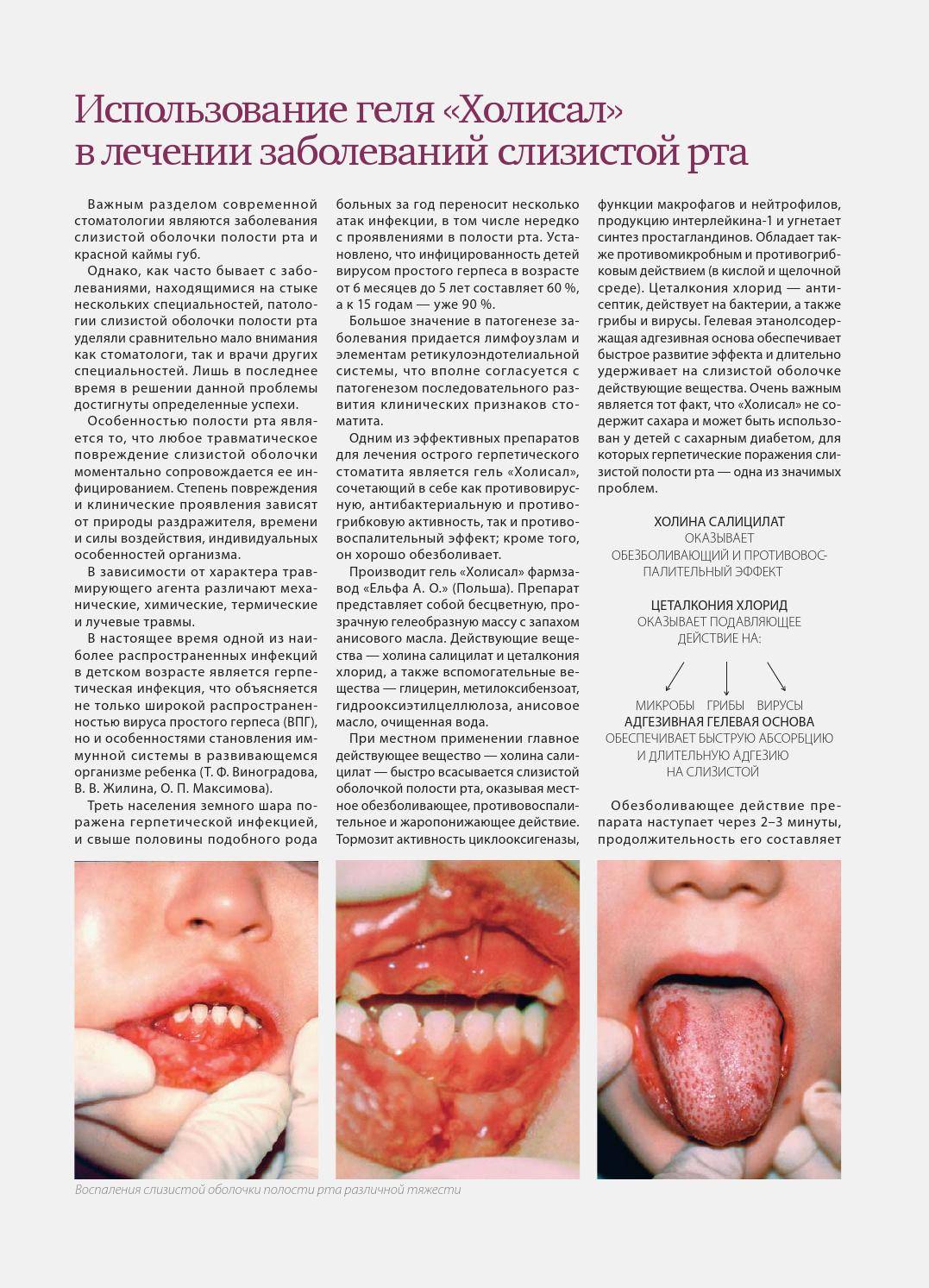 Болезни полости рта, их симптомы и методы лечения